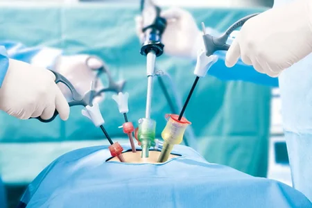 General Laparoscopic Surgery