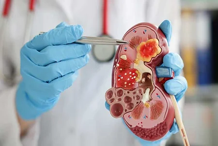 Nephrologist Renal